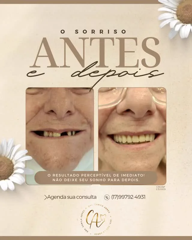 Antes e depois: Um novo sorriso